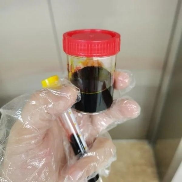 急性肝衰竭！兩兄弟誤吃這種菌 專家提醒