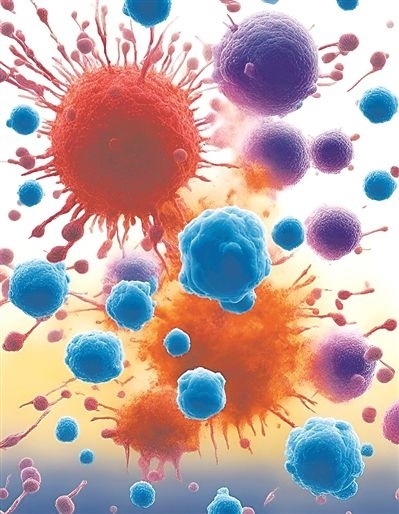 用氯化鈉處理的高活性CD8 T細胞（紫色），與未經(jīng)處理的細胞（藍色）相比，其抗腫瘤能力更強，能夠顯著損傷腫瘤細胞（紅色）。圖片來源：德國耶拿弗里德里希·席勒大學(xué)